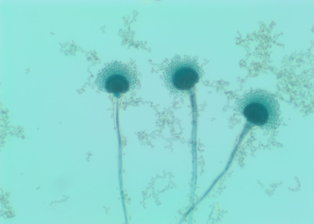 An enlarged view of fungal spores 