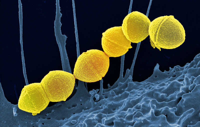 A microscopic image of strep bacteria