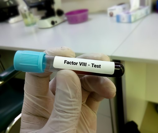 A gloved hand holds a test tube with the label 'Factor VIII test'.